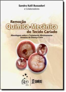 Imagem de REMOCAO QUIMICA E MECANICA DO TECIDO CARIADO