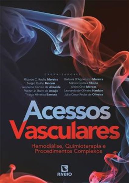 Picture of ACESSOS VASCULARES - HEMODIALISE, QUIMIOTERAPIA E PROCEDIMENTOS COMPLEXOS