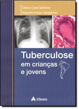 Imagem de TUBERCULOSE EM CRIANCAS E JOVENS