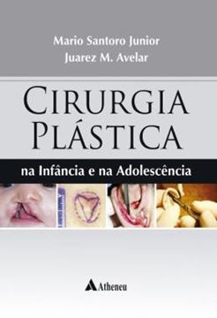 Imagem de CIRURGIA PLASTICA - NA INFANCIA E NA ADOLESCENCIA