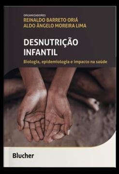 Imagem de DESNUTRICAO INFANTIL - BIOLOGIA, EPIDEMIOLOGIA E IMPACTO NA SAUDE