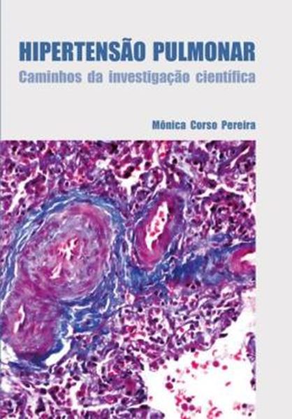 Picture of HIPERTENSAO PULMONAR