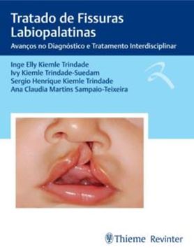Imagem de TRATADO DE FISSURAS LABIOPALATINAS