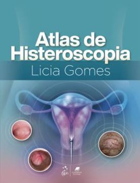 Imagem de ATLAS DE HISTEROSCOPIA