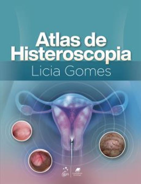 Picture of ATLAS DE HISTEROSCOPIA
