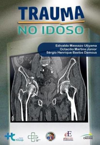 Picture of TRAUMA NO IDOSO