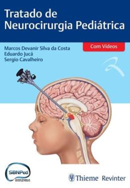 Picture of TRATADO DE NEUROCIRURGIA PEDIATRICA
