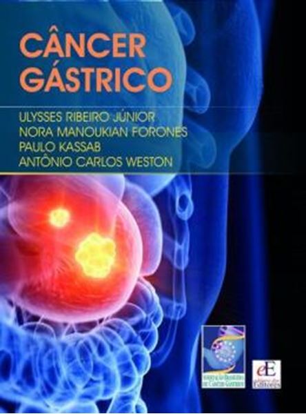 Picture of CANCER GASTRICO